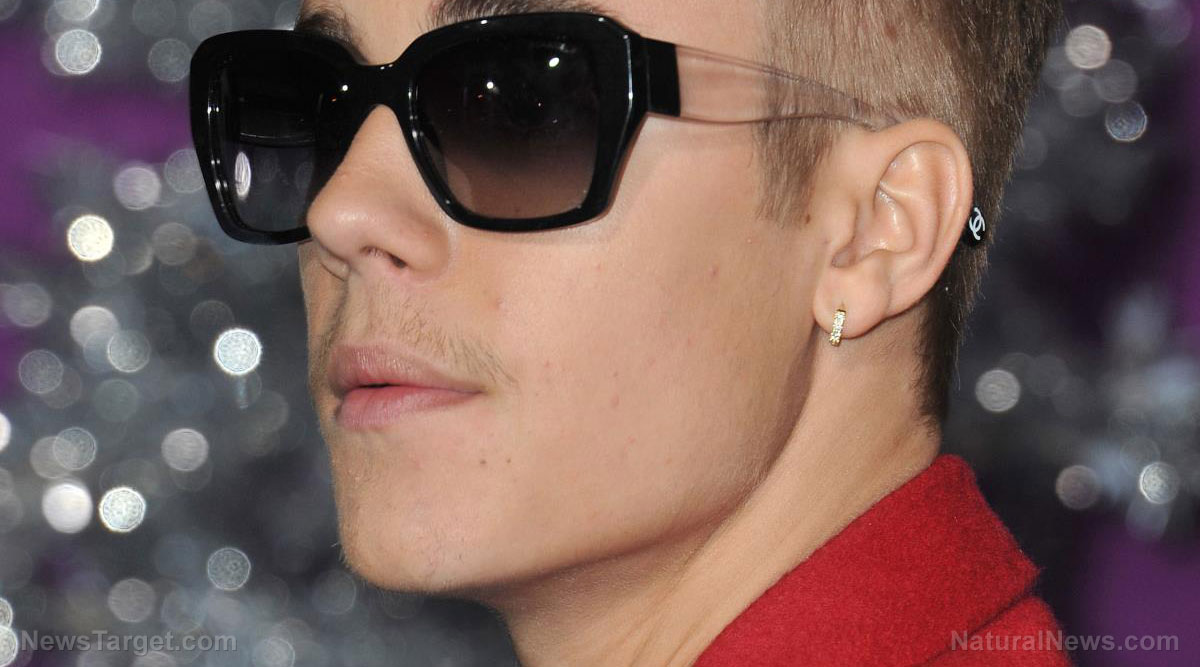 LE VISAGE DE JUSTIN BIEBER PARALYSE PAR LE SYNDROME DE RAMSAY HUNT, UN EFFET INDESIRABLE CONNU DES INJECTIONS DE COVID